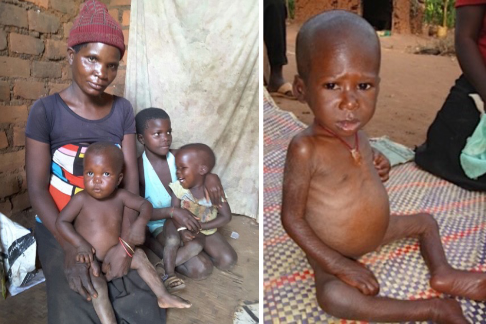 Medcare Covid update and appeal to save the starving